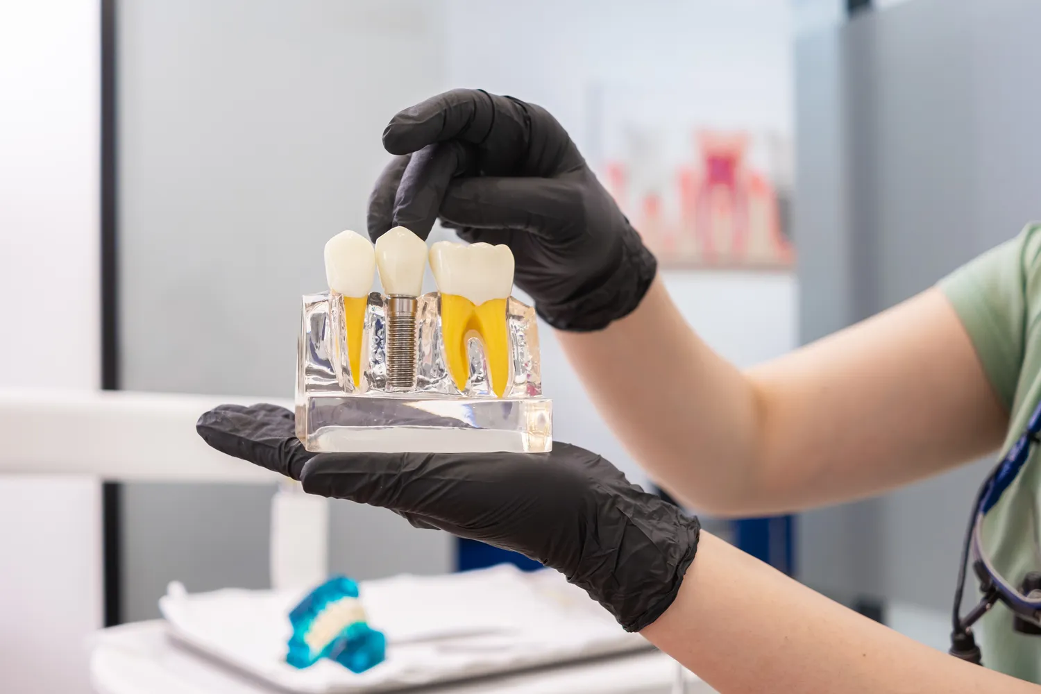 Ile kosztują implanty dla seniorów?